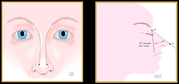 Rhinoplastie Procedures