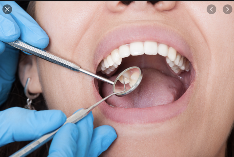 Top Five Practices to Maintain Healthy Teeth and Gums