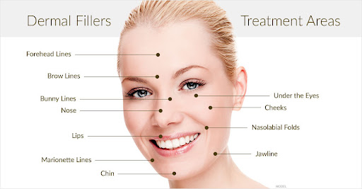The American Society of Plastic Surgeons (ASPS) indicates a two percent increase in the numdermal fillers