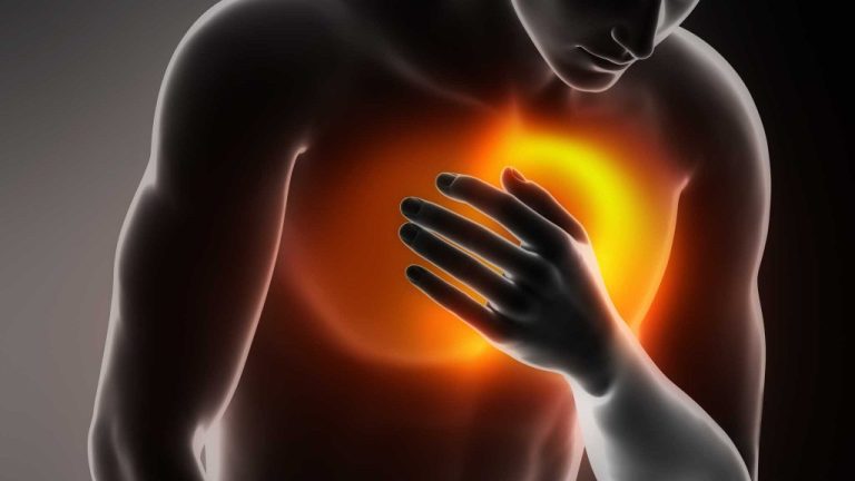 Top Five Herbal Remedies For Acid Reflux And Heartburn