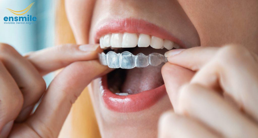 Invisible Braces