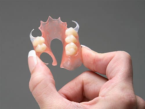 Everything You Need To Know About Flexible Denture
