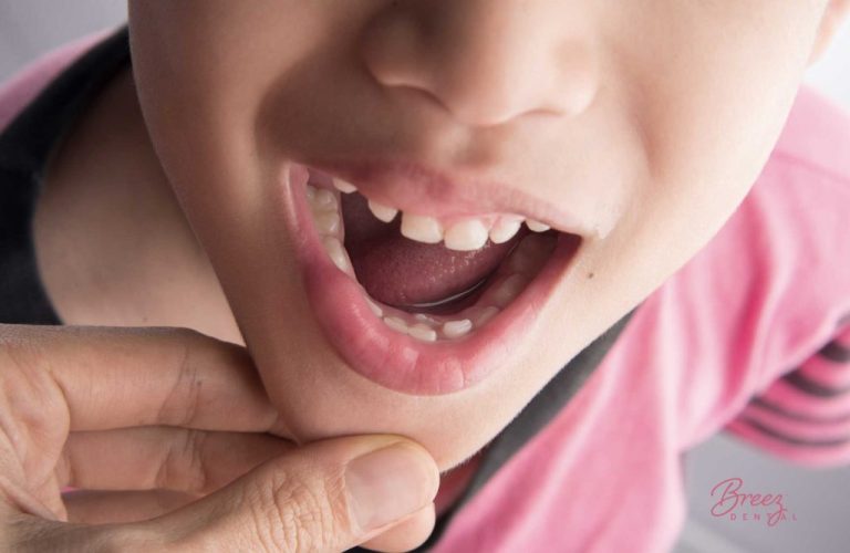 What Every Parent Needs To Know About Permanent Teeth