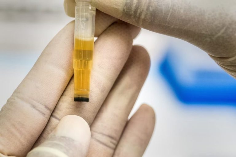 5 Best Synthetic Urine Kits For Drug Testing
